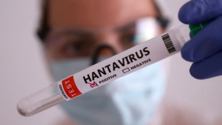 https://www.tp24.it/immagini_articoli/10-05-2026/cosa-sappiamo-sull-hantavirus-e-come-il-covid-250.jpg