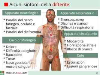 https://www.tp24.it/immagini_articoli/22-08-2026/difterite-a-palermo-indagati-i-genitori-di-anna-rosa-il-cuginetto-e-positivo-250.jpg