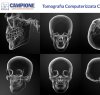 https://www.tp24.it/immagini_articoli/07-04-2023/1680858476-0-la-tc-cone-beam-al-centro-campione-diagnosi-rapida-delle-patologie-facciali.jpg