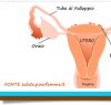 https://www.tp24.it/immagini_articoli/25-03-2012/1379491867-1-endometriosi-ovaio-come-rimuoverla-senza-rischi.jpg