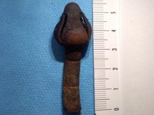 https://www.tp24.it/immagini_articoli/29-11-2019/1575012751-0-trovano-stomaco-pezzo-tubo-risalente-anni.jpg